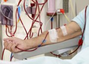 Biaya Hemodialisis Masih Jadi Beban Berat, Pemerintah Diminta Perbaiki Skema Pembiayaan
