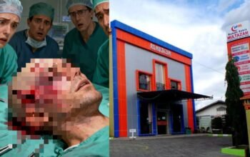 Tindakan Bedah Kepala RS Multazam diduga Bermasalah, Pasien Alami Komplikasi Berat hingga Skin Grafting Gagal